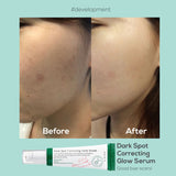 AXIS-Y Dark Spot Correcting Glow Serum 50ml - sheesha
