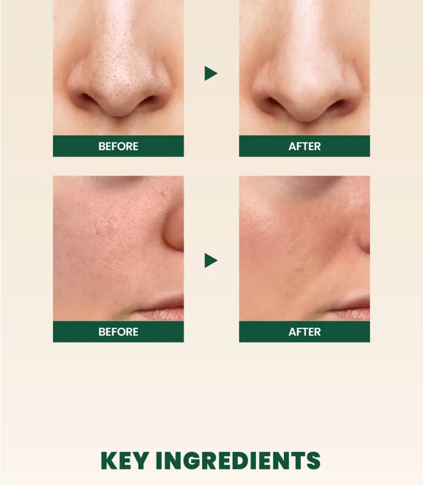 K-SECRET SEOUL 1988 Pine Cica 1% + Probiotics Foam Cleanser 150ml - sheesha