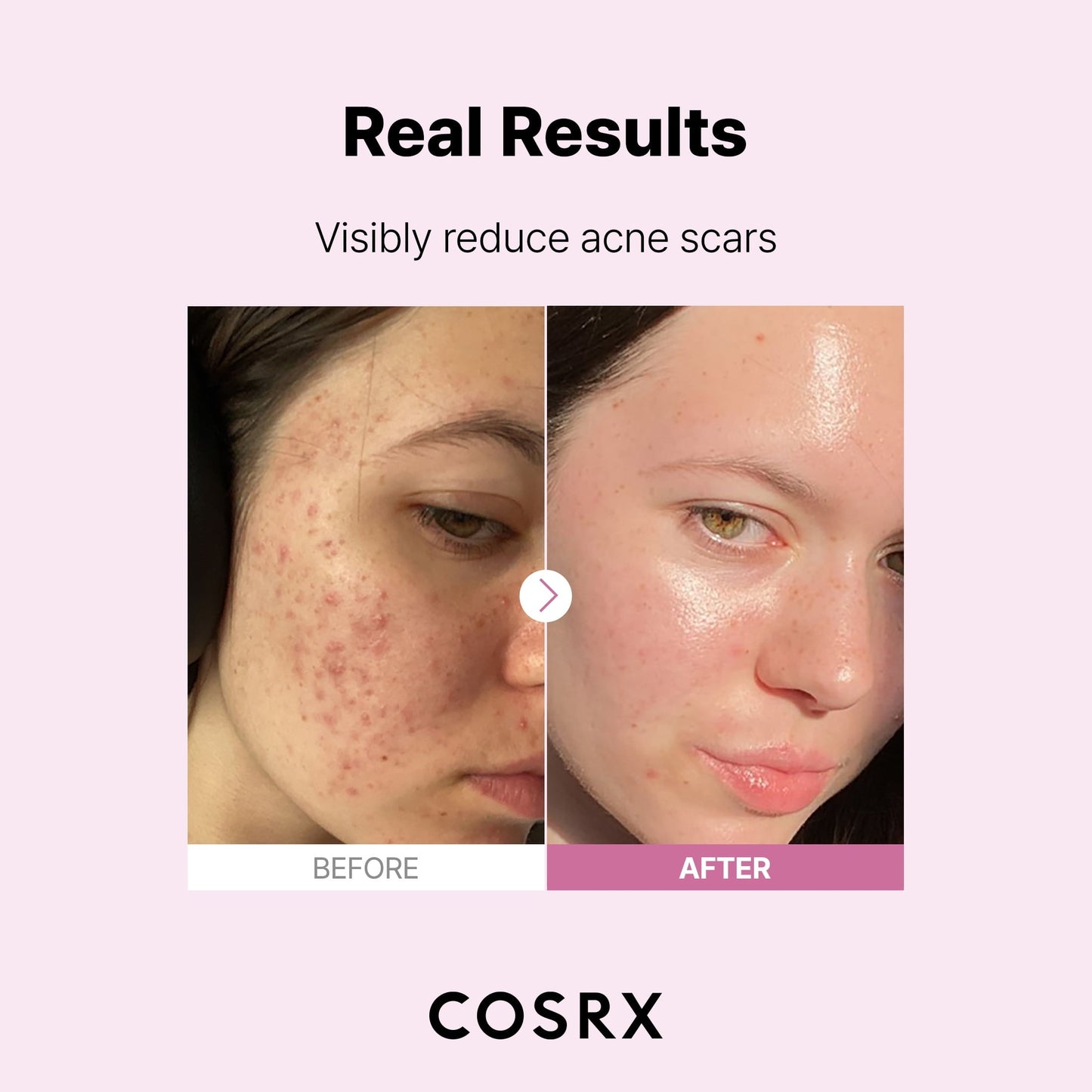 COSRX The Niacinamide 15 Serum 20ml - sheesha