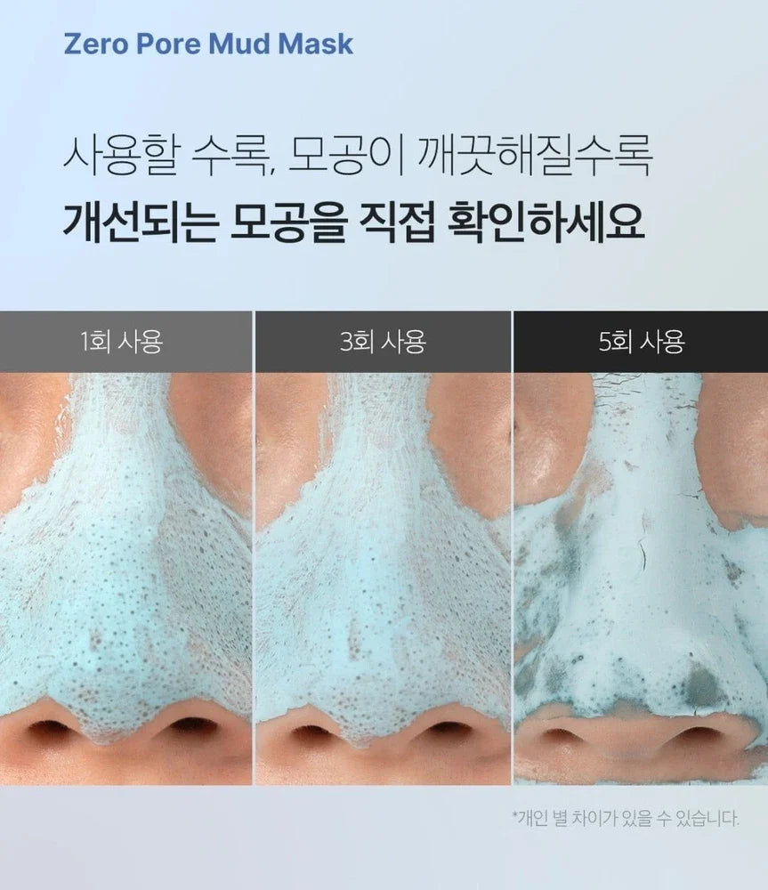 Medicube Zero Pore Blackhead Mud Mask 100g - sheesha