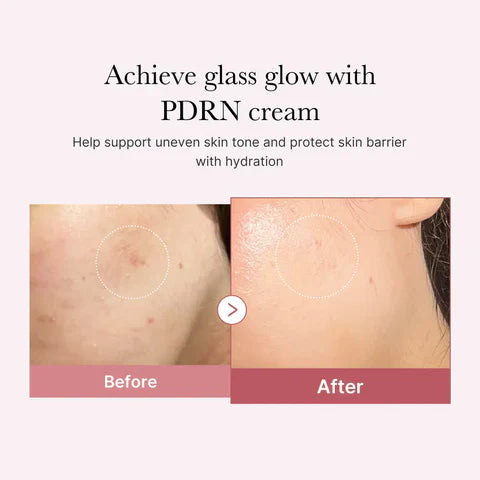 Medicube PDRN Pink Hyaluronic Moisturizing Cream 50ml - sheesha