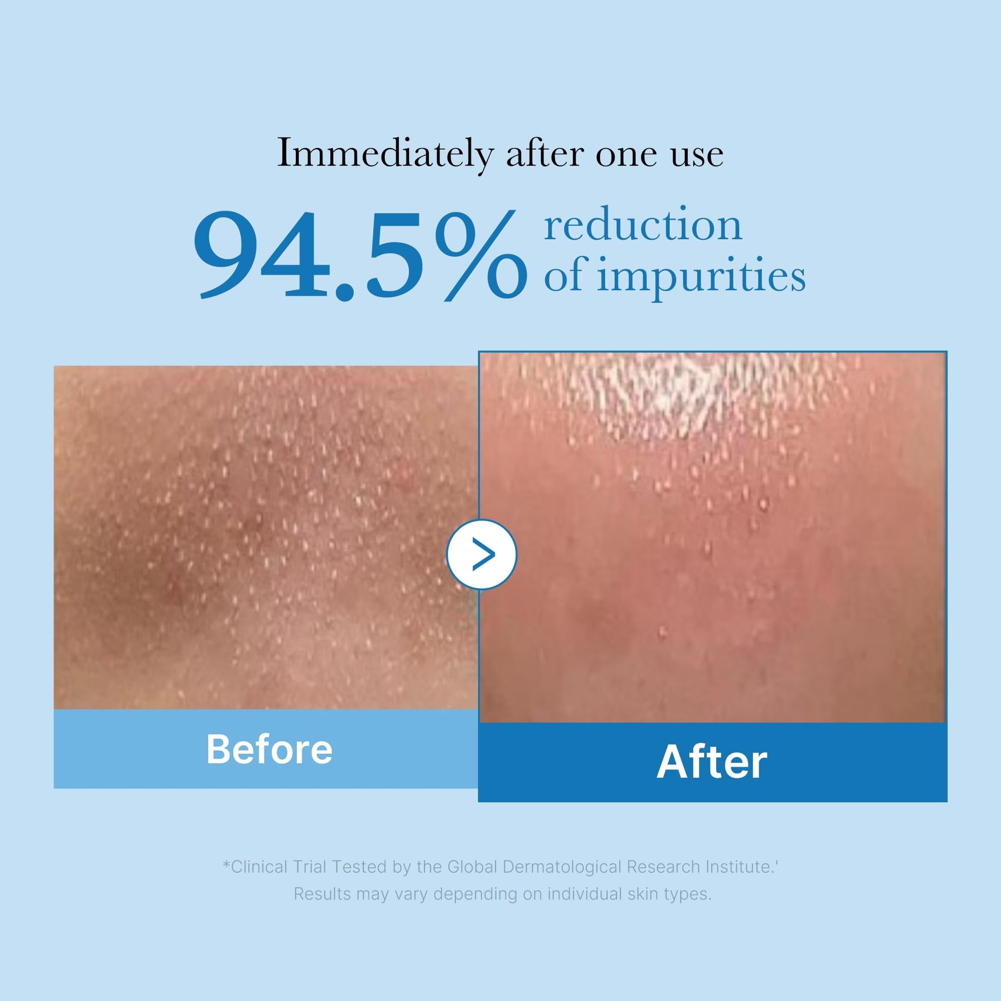 Medicube Zero Pore Blackhead Deep Cleansing Oil 205ml - sheesha