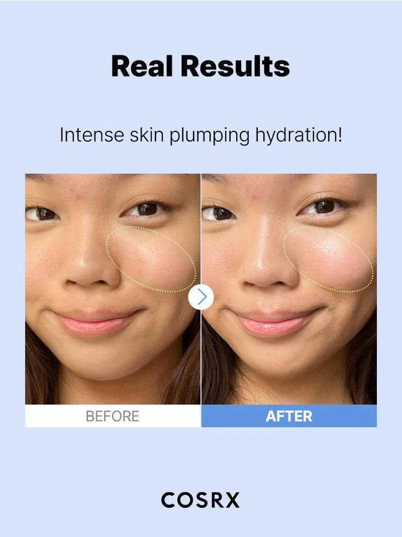COSRX The Hyaluronic Acid 3 Serum 20ml - sheesha
