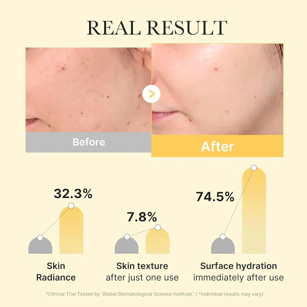 Medicube Kojic Acid Turmeric Brightening Gel Mask - sheesha